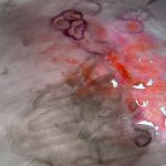 Eclat de voix par Mari BONAIL