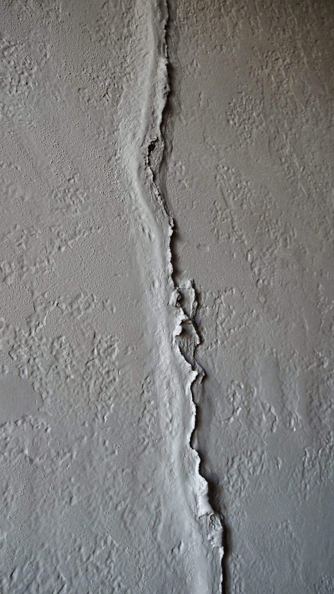 cicatrice-detail-mac-arteum